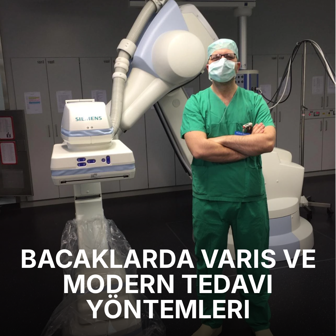 Bacaklarda Varis ve Modern Tedavi Yöntemleri